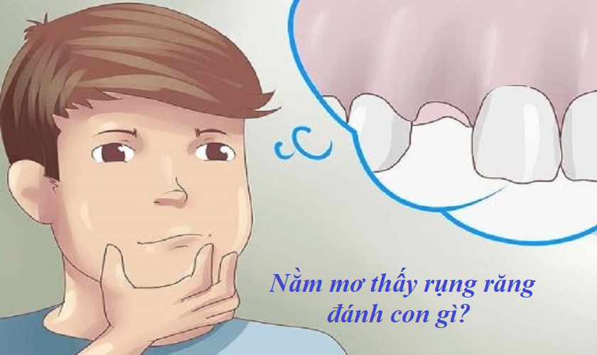 rụng răng 
